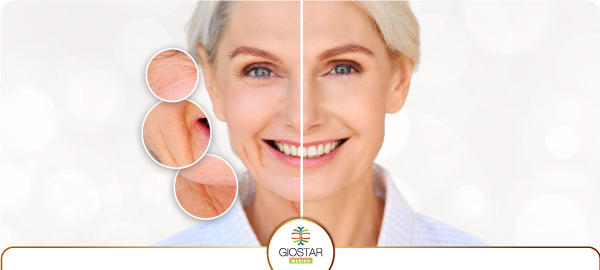 anti_aging_facial_rejuvenetion_GiostarMexico